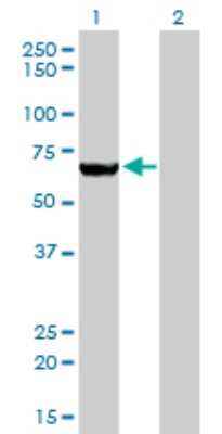 Western Blot: MTMR2 Antibody (4G6) [H00008898-M03]