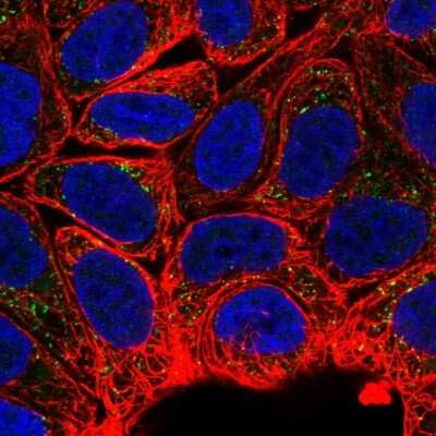 Immunocytochemistry/ Immunofluorescence: MTMR2 Antibody [NBP2-33580]