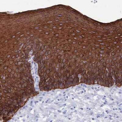 Immunohistochemistry-Paraffin: MTMR2 Antibody [NBP2-33580]
