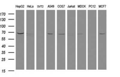 Western Blot: MTMR2 Antibody (OTI1F10)Azide and BSA Free [NBP2-72810]