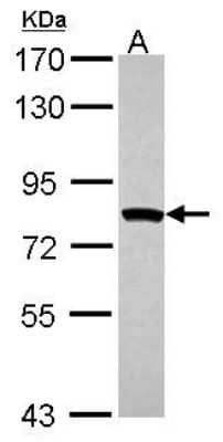 Western Blot: MTMR2 Antibody [NBP2-19434]