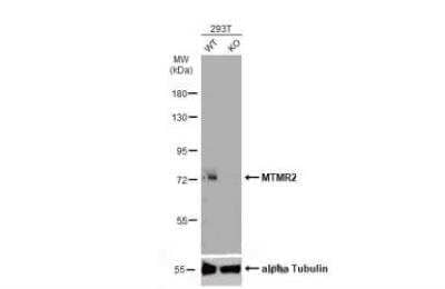 Western Blot: MTMR2 Antibody [NBP2-19434]