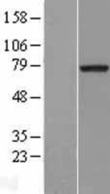 Western Blot: MTMR2 Overexpression Lysate [NBL1-13375]