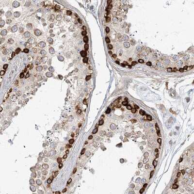 Immunohistochemistry-Paraffin: MTMR3 Antibody [NBP1-81860]