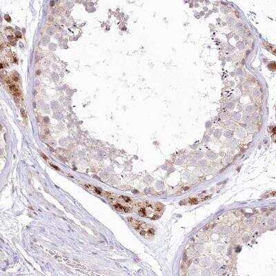 Immunohistochemistry-Paraffin: MTMR3 Antibody [NBP1-81861]