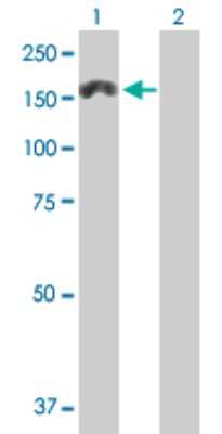 Western Blot: MTMR3 Antibody [H00008897-B01P]