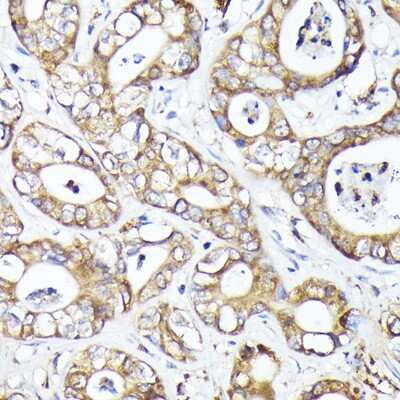 Immunohistochemistry-Paraffin: MTMR4 Antibody - BSA Free [NBP3-05113]