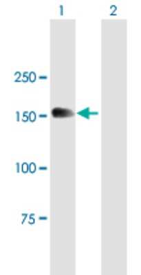 Western Blot: MTMR4 Antibody [H00009110-B01P]