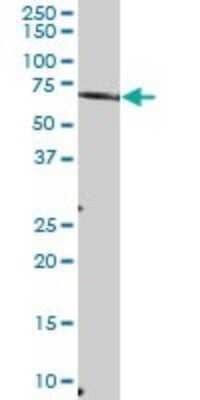 Western Blot: MTMR6 Antibody [H00009107-B01P]