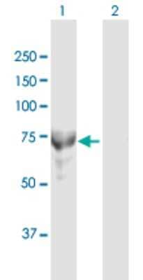 Western Blot: MTMR6 Antibody [H00009107-D01P]