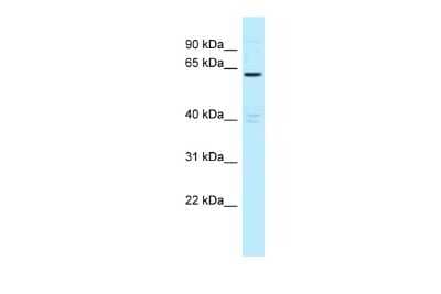 Western Blot: MTMR6 Antibody [NBP2-86715]