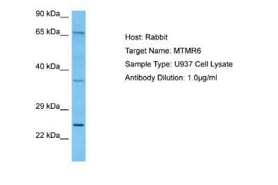 Western Blot: MTMR6 Antibody [NBP2-86716]