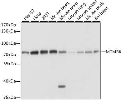 Western Blot: MTMR6 AntibodyAzide and BSA Free [NBP2-94705]