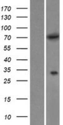 Western Blot: MTMR6 Overexpression Lysate [NBP2-07840]