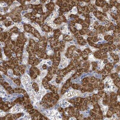 Immunohistochemistry: ASB12 Antibody [NBP2-46775]