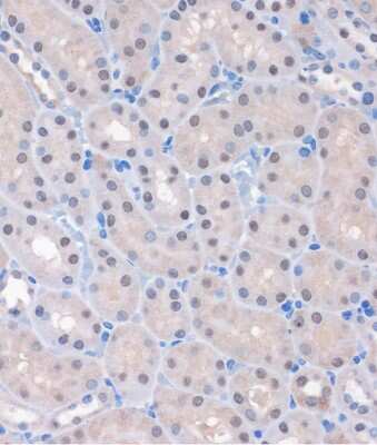 Immunohistochemistry-Paraffin: MTMR8 Antibody - Azide and BSA Free [NBP2-94380]
