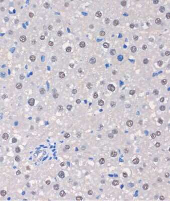 Immunohistochemistry-Paraffin: MTMR8 Antibody - Azide and BSA Free [NBP2-94380]