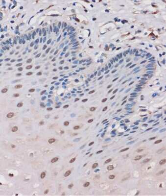 Immunohistochemistry-Paraffin: MTMR8 Antibody - Azide and BSA Free [NBP2-94380]