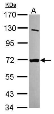 Western Blot: MTMR8 Antibody [NBP2-15027]