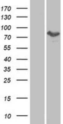 Western Blot: MTMR8 Overexpression Lysate [NBP2-06947]