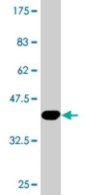 Western Blot: MTMR9 Antibody (4A9) [H00066036-M01]