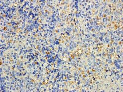 Immunohistochemistry-Paraffin: MTMR9 Antibody [NB100-832]