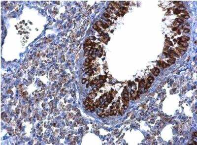 Immunohistochemistry-Paraffin: MTMR9 Antibody [NBP1-31078]