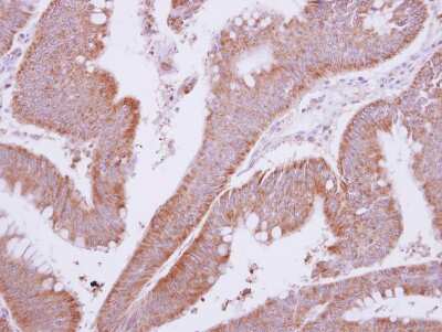 Immunohistochemistry-Paraffin: MTMR9 Antibody [NBP2-19435]