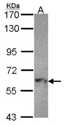 Western Blot: MTMR9 Antibody [NBP1-31078]