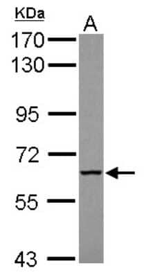 Western Blot: MTMR9 Antibody [NBP2-19435]