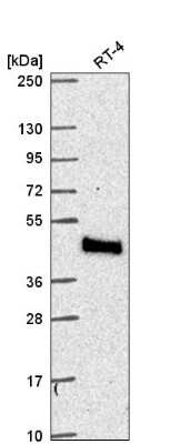 Western Blot: MTMR9 Antibody [NBP2-57980]