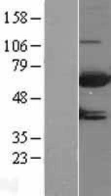 Western Blot: MTMR9 Overexpression Lysate [NBL1-13377]