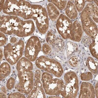 Immunohistochemistry-Paraffin: MTO1 Antibody [NBP1-85932]