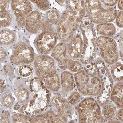Immunohistochemistry-Paraffin: MTO1 Antibody [NBP1-85933]