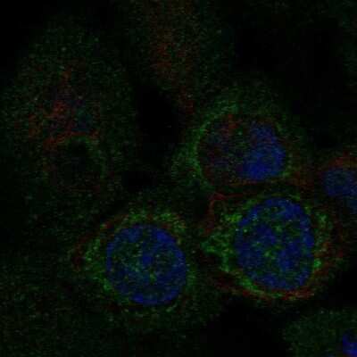 Immunocytochemistry/ Immunofluorescence: MTP18 Antibody [NBP2-57803]