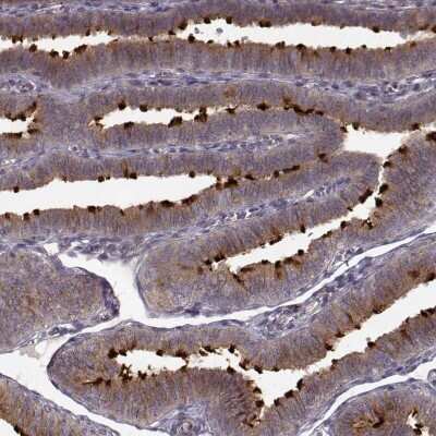 Immunocytochemistry/ Immunofluorescence: MTR Antibody [NBP2-68713]