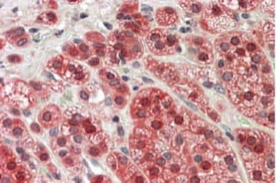 Immunohistochemistry-Paraffin: MTR Antibody [NB100-791]