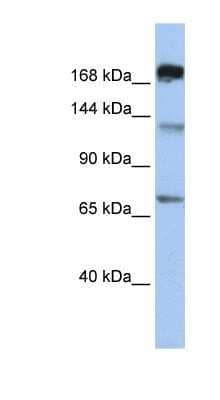 Western Blot: MTR Antibody [NBP1-79285]