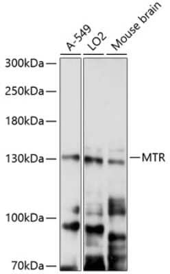 Western Blot: MTR AntibodyAzide and BSA Free [NBP2-93312]