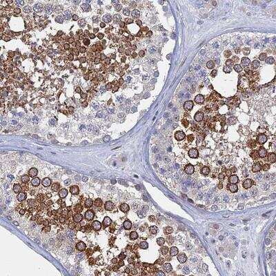 Immunohistochemistry-Paraffin: MTRF1 Antibody [NBP1-81067]