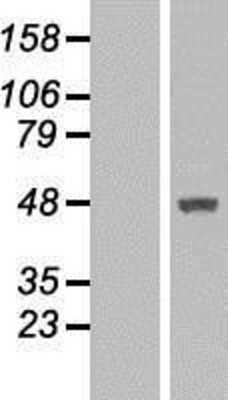 Western Blot: MTRF1 Overexpression Lysate [NBL1-13383]