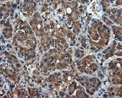 Immunohistochemistry-Paraffin: MTRF1L Antibody (OTI1D11) [NBP2-02384]