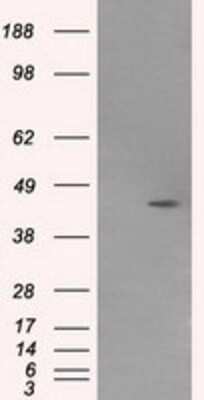 Western Blot: MTRF1L Antibody (OTI1D11) [NBP2-02384]