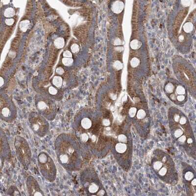 Immunohistochemistry-Paraffin: MTRF1L Antibody [NBP1-85893]