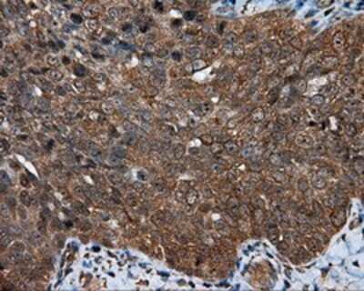 Immunohistochemistry: MTRF1L Antibody (OTI1D11) - Azide and BSA Free [NBP2-72814]