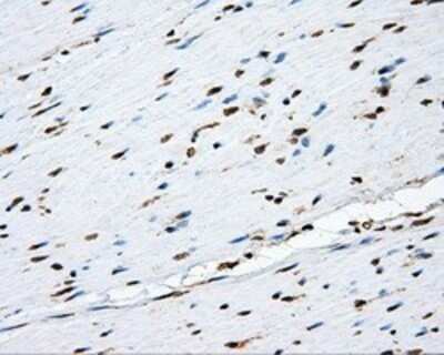 Immunohistochemistry: MTRF1L Antibody (OTI1D11) - Azide and BSA Free [NBP2-72814]