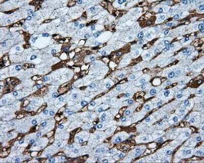 Immunohistochemistry: MTRF1L Antibody (OTI1D11) - Azide and BSA Free [NBP2-72814]