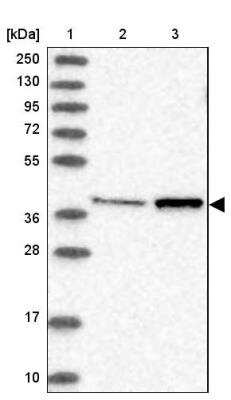 Western Blot: MTRF1L Antibody [NBP1-85893]