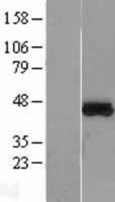 Western Blot: MTRF1L Overexpression Lysate [NBL1-13384]