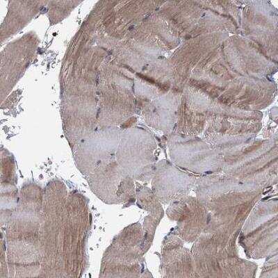 Immunohistochemistry-Paraffin: MTRR Antibody [NBP1-86596]